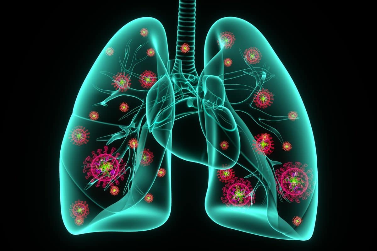o que é pneumonia?